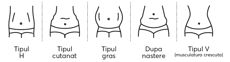 X-Sculpt-Tonifiere-musculara2